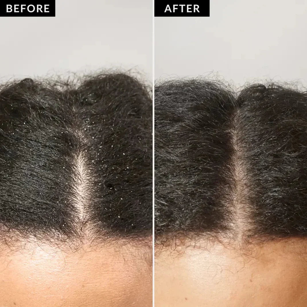 Noree Scalp Detox Comb